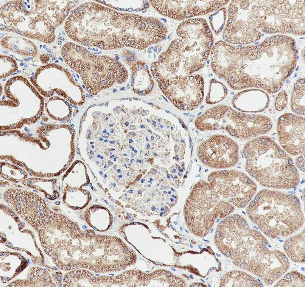 Recombinant SPR Monoclonal Antibody-searchlist-2