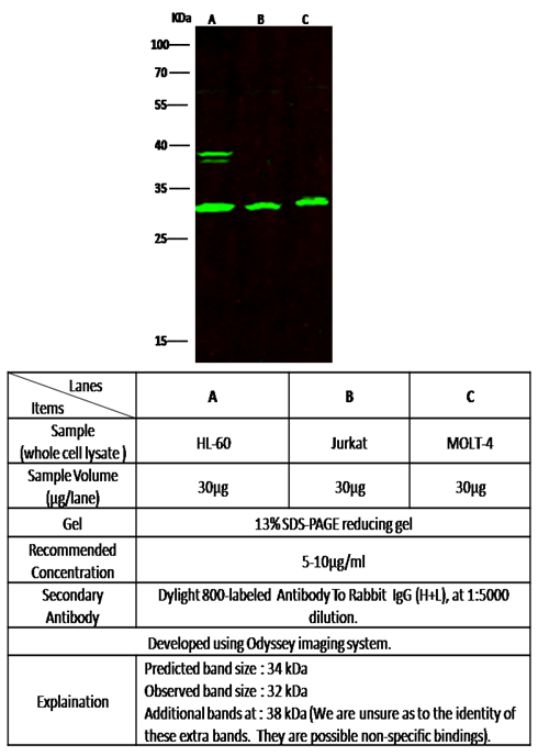 Recombinant BLyS/TNFSF13B/BAFF Monoclonal Antibody - small - 2