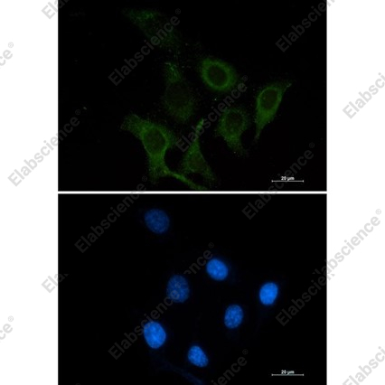 Recombinant CD166 Monoclonal Antibody - 3