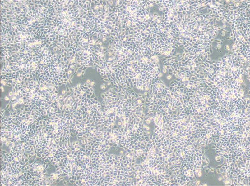 RT-112 Cell Complete Medium - 3