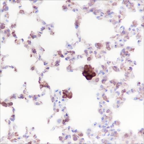 Recombinant iNOS Monoclonal Antibody - 2