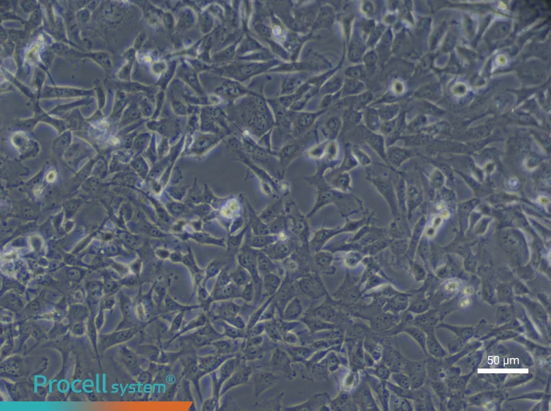 Human Cardiac Microvascular Endothelial (Primary cell immortalization) Cell Complete Medium - 6