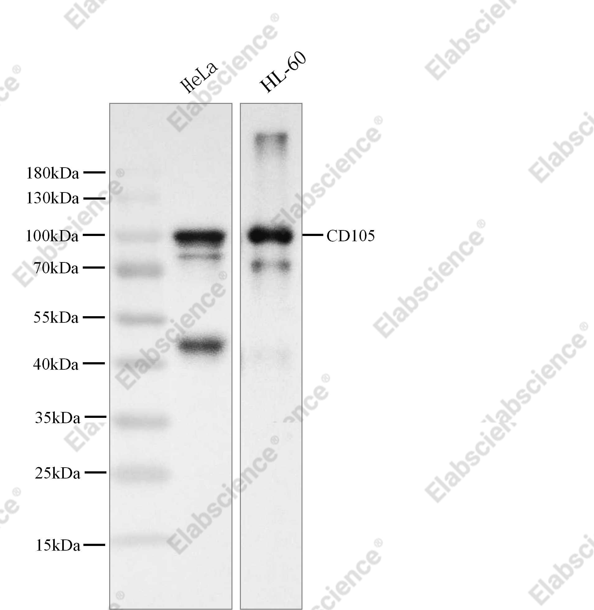 Recombinant Endoglin/CD105 Monoclonal Antibody - 3