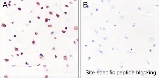 Recombinant Histone H3 (Acetyl Lys122) Monoclonal Antibody - small - 4