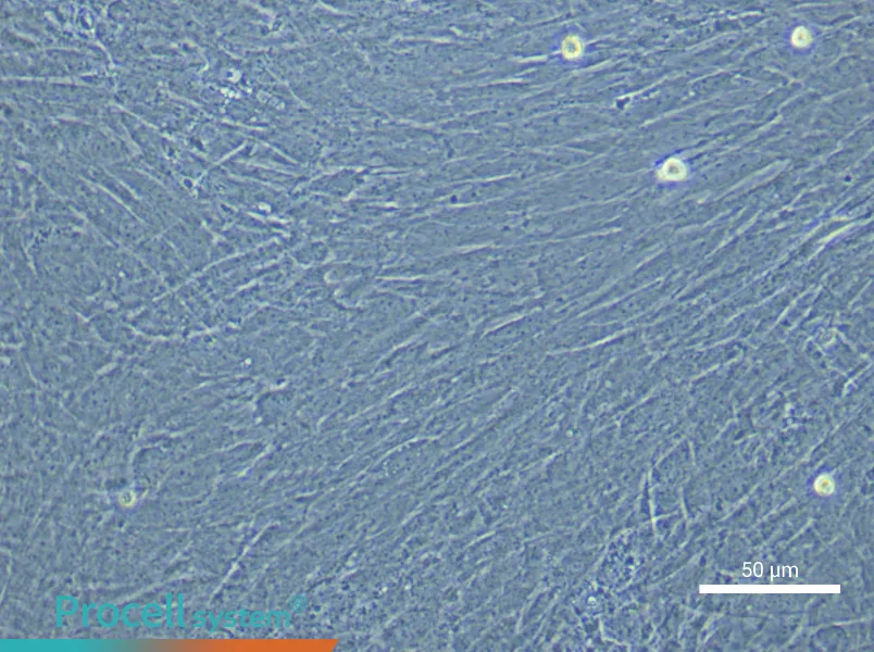 Mouse Mesenteric Smooth Muscle Cell Complete Medium - 6