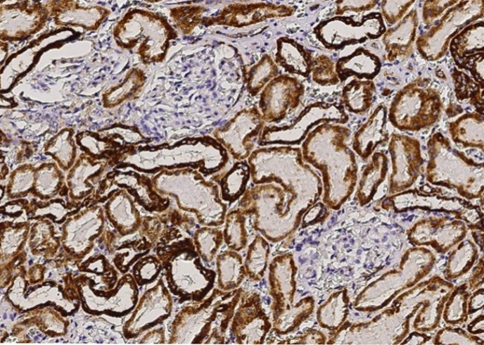 Recombinant AK2/Adenylate kinase 2 Monoclonal Antibody - small - 2