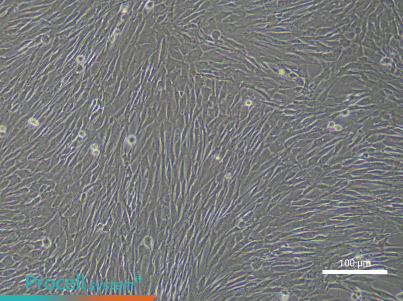 Human Cardiac Fibroblast (Primary cell immortalization) Complete MediumHuman Cardiac Fibroblast (Primary cell immortalization) Complete Medium - 2