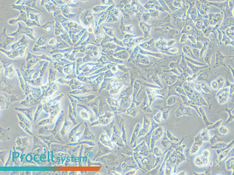 VCaP Cell Complete Medium - small - 6