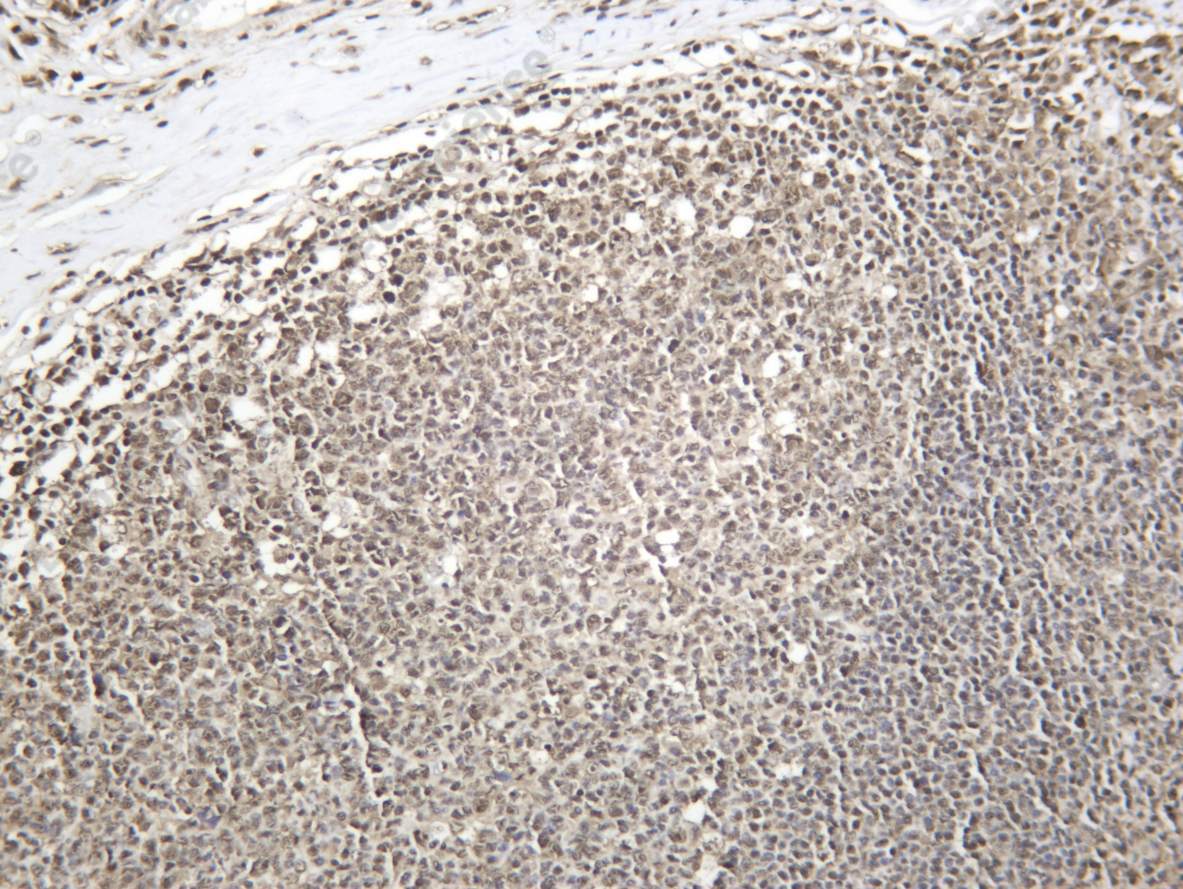 Recombinant HP1γ Monoclonal Antibody - 2