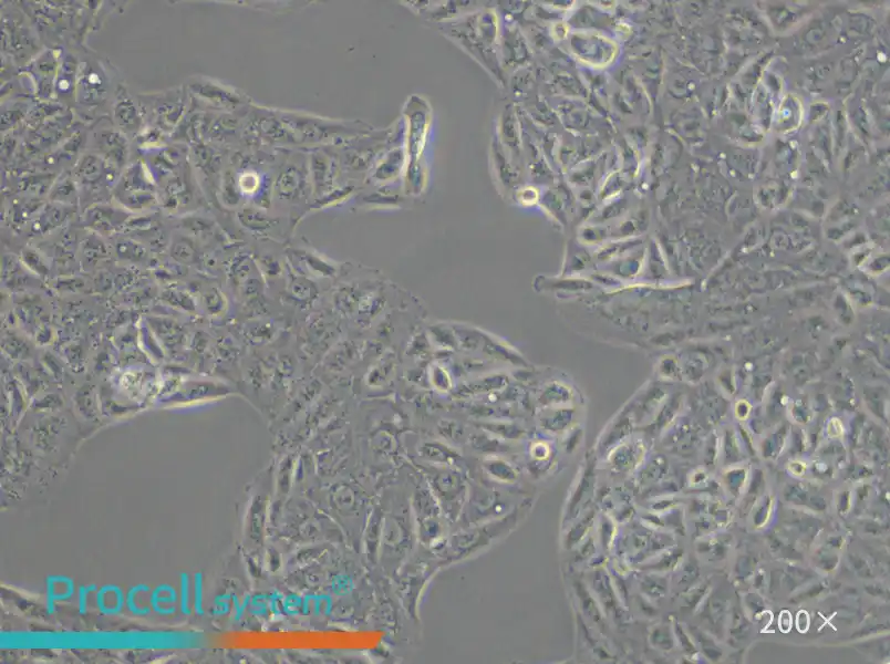 ACHN Cell Complete Medium - small - 4