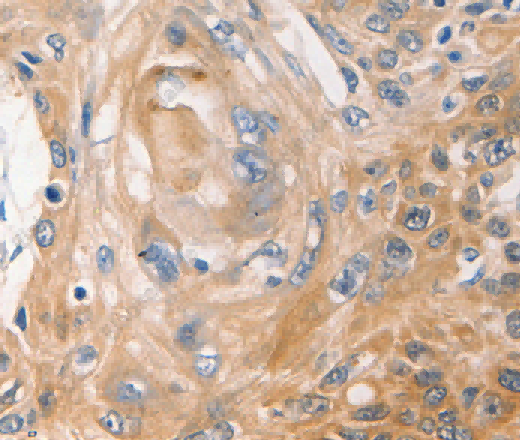NME1 Polyclonal Antibody - 2