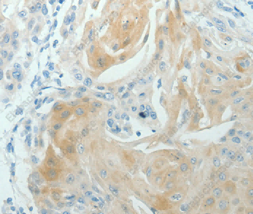 RNF126 Polyclonal Antibody - 3