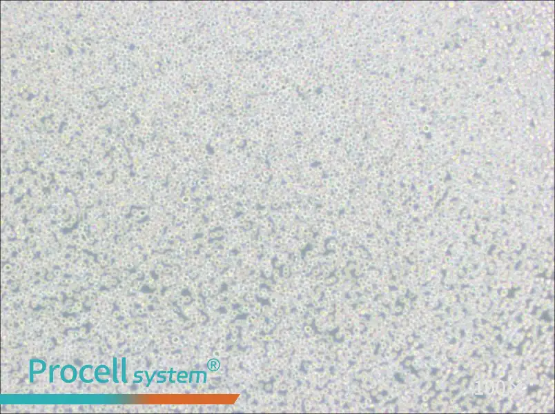 BALL-1 Cell Complete MediumBALL-1 Cell Complete Medium - 2