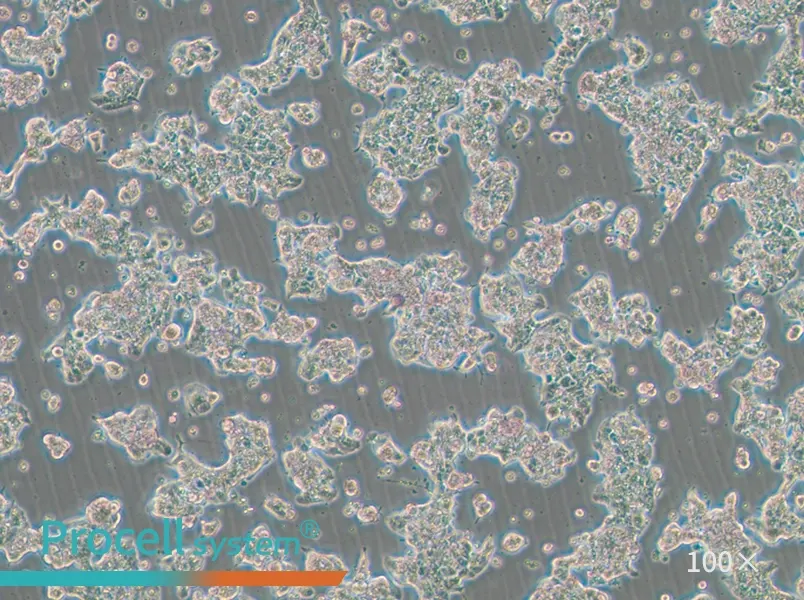 ZR-75-1 Cell Complete MediumZR-75-1 Cell Complete Medium - 3