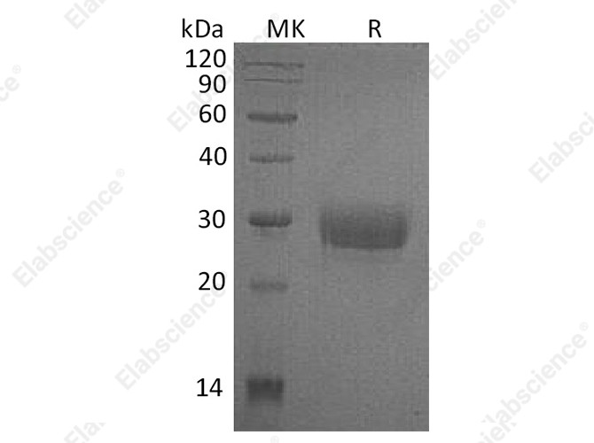 Recombinant Human CD32a/FCGR2A Protein (H131, His Tag) - 1