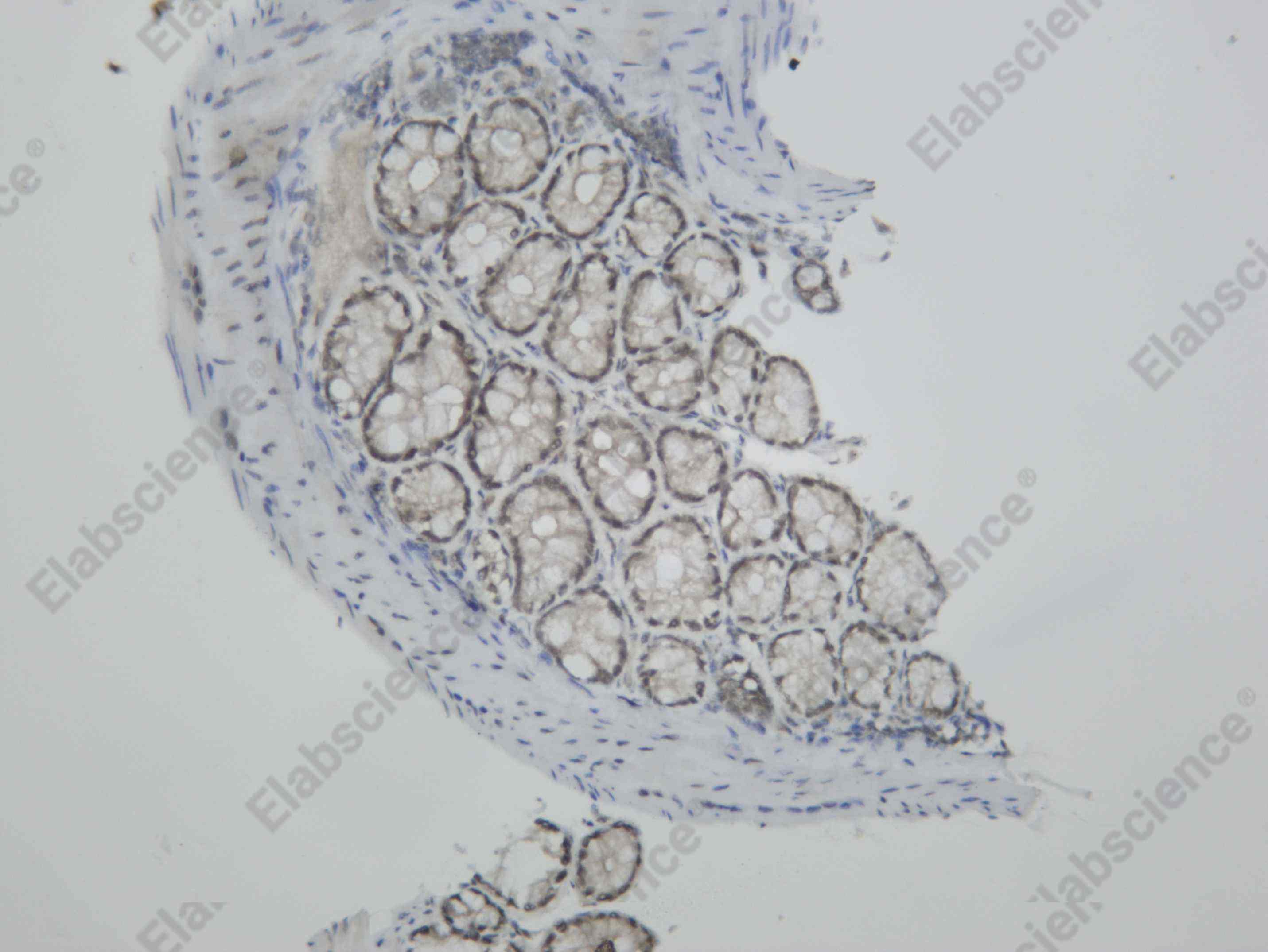 Recombinant Casein Kinase II α Monoclonal Antibody - 3