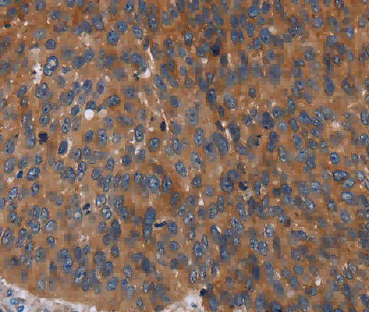 Catenin gamma Polyclonal Antibody - 3