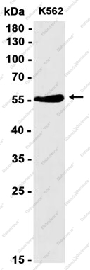 Recombinant PRAME Monoclonal Antibody - 1