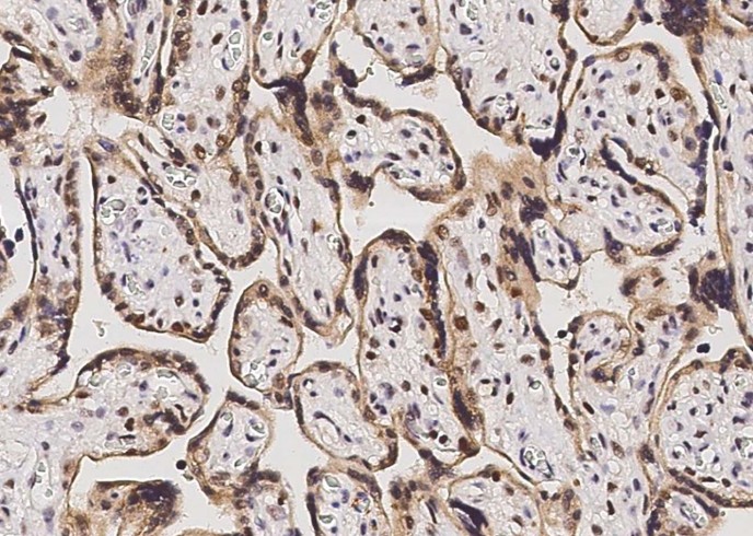 p38 alpha/MAPK14 Monoclonal Antibody - small - 2