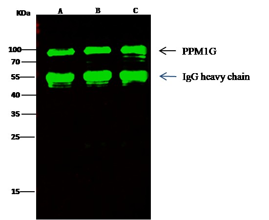 Recombinant PPM1G Monoclonal Antibody - small - 2