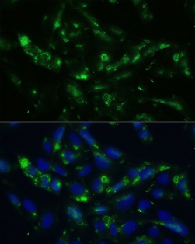 Immunofluorescence analysis of U2OS cells using CGRP Polyclonal Antibody at dilution of 1:100. Blue: DAPI for nuclear staining.