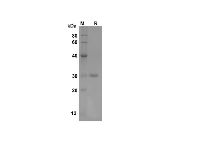 Recombinant Mouse CD4/LEU3 Protein(His Tag)-产品推荐-1