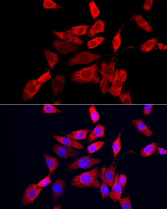 Immunofluorescence analysis of NIH/3T3 cells using CXCL10/IP-10 Polyclonal Antibody at dilution of 1:200 (40x lens). Blue:DAPI for nuclear staining.