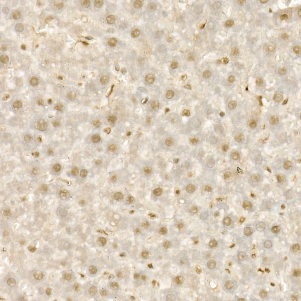 Immunohistochemistry of paraffin-embedded rat liver using KDM1A Polyclonal Antibody at dilution of 1:100 (40x lens).Perform high pressure antigen retrieval with 10 mM citrate buffer pH 6.0 before commencing with IHC staining protocol.