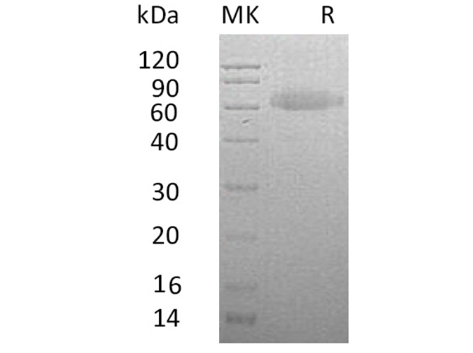 Recombinant Human RSPO3 Protein (Fc & His Tag)