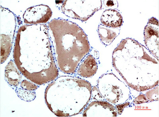 Immunohistochemistry of paraffin-embedded Human Thyroid tissue using TTR Monoclonal Antibody at dilution of 1:200.