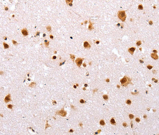 Immunohistochemistry of paraffin-embedded Human brain tissue using TBX2 Polyclonal Antibody at dilution 1:32