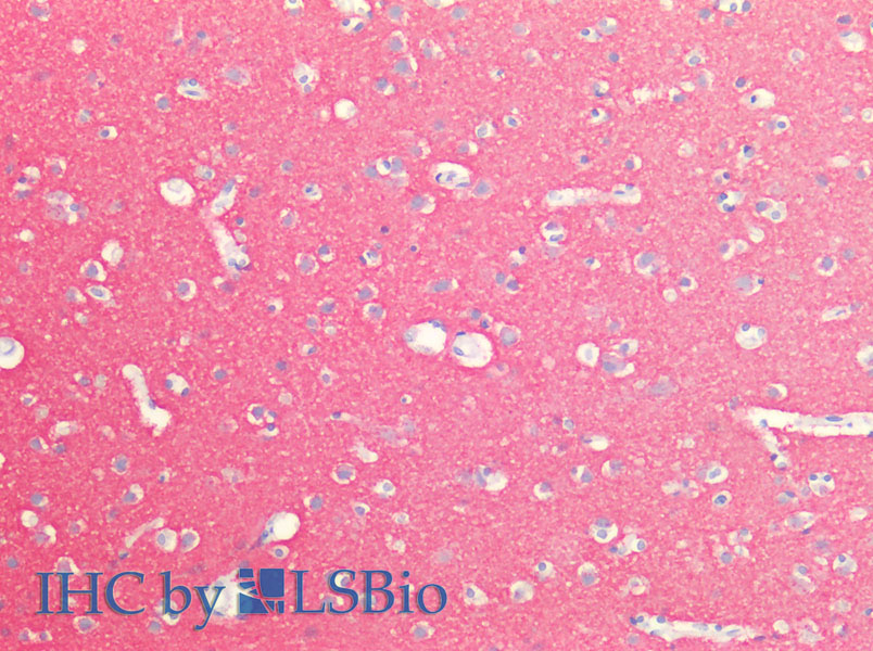 Immunohistochemistry of paraffin-embedded Human Brain using SNAP25 Polyclonal Antibody at dilution of 1:100(Elabscience Product Detected by Lifespan).