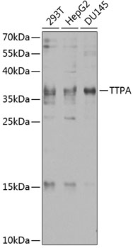 Western blot analysis of extracts of various cell lines using TTPA Polyclonal Antibody at 1:1000 dilution.