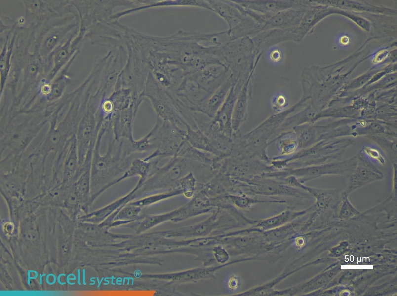 Rat Uterine Fibroblast Complete Medium - 4