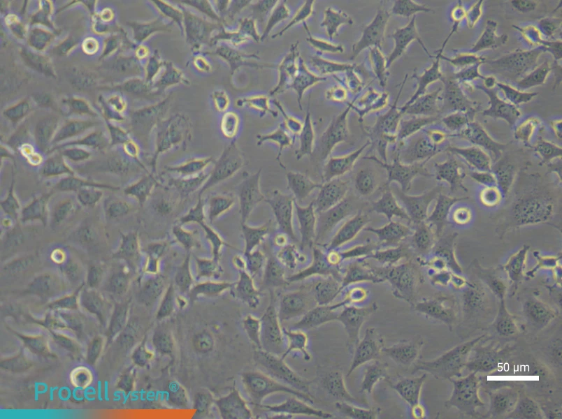 Mouse Aortic Endothelial Cells (Primary cell immortalization)Mouse Aortic Endothelial Cells (Primary cell immortalization) - 5