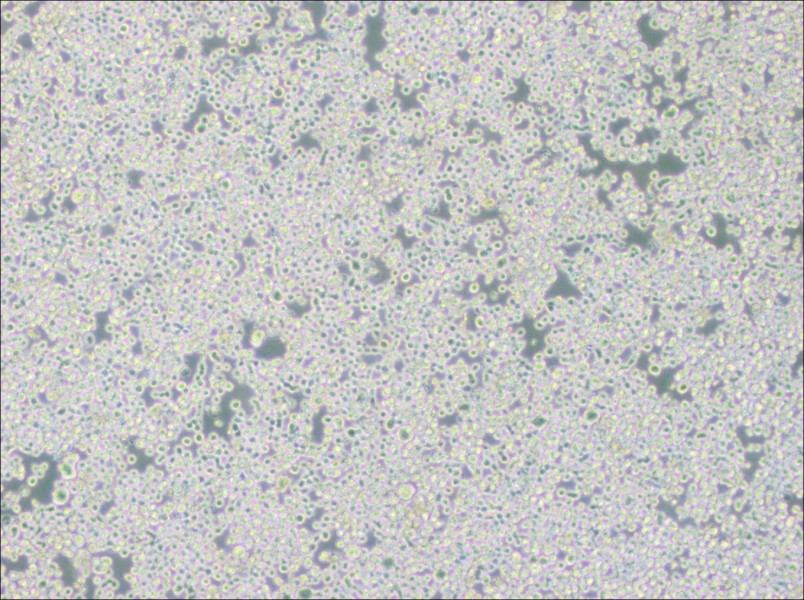 RPMI 8226 Cell Complete Medium - 2