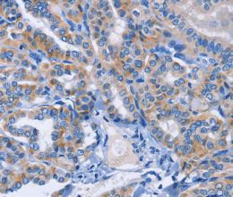 AMACR Polyclonal Antibody - 2