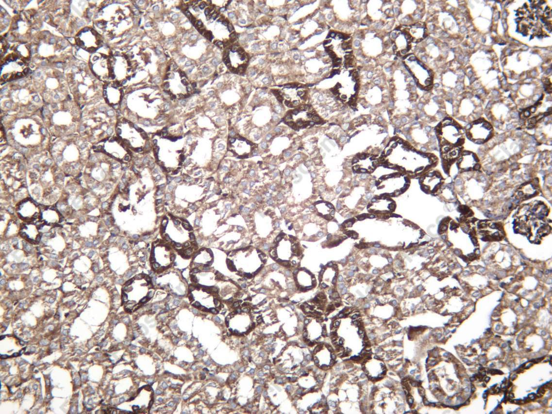 Recombinant SCRB2 Monoclonal Antibody - 3