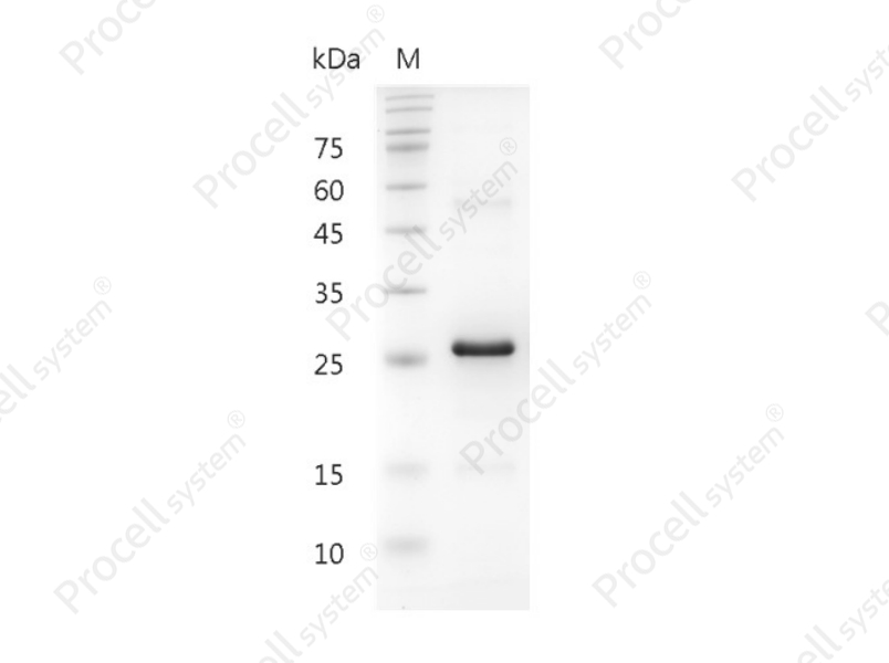 Noggin/NOG/SYM1/SYNS1, Human, Recombinant