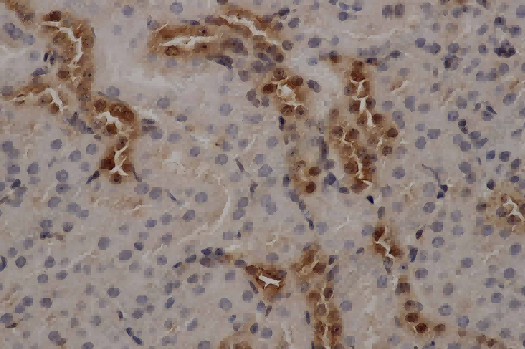 ANXA5 Polyclonal Antibody - 2