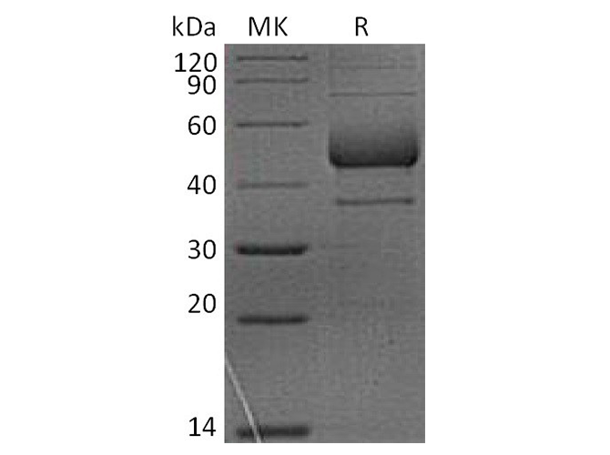 Recombinant Rhesus macaque ICOS/AILIM/CD278 Protein (Fc Tag)