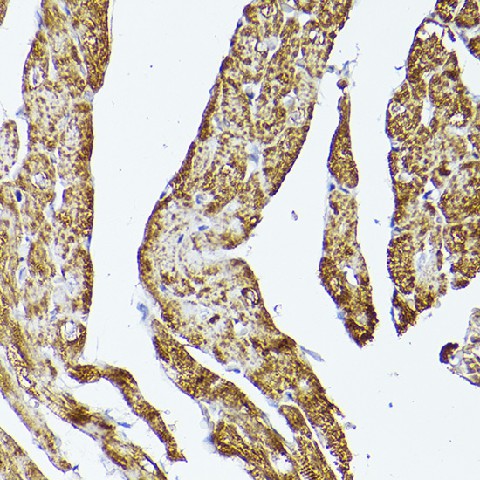 Immunohistochemistry of paraffin-embedded rat heart using VDAC2 Polyclonal Antibody at dilution of 1:100 (40x lens).Perform high pressure antigen retrieval with 10 mM citrate buffer pH 6.0 before commencing with IHC staining protocol.