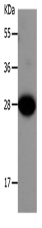 Western Blot analysis of Mouse liver tissue using IGFBP1 Polyclonal Antibody at dilution of 1:550