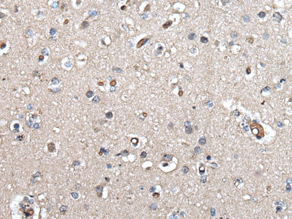 Immunohistochemistry of paraffin-embedded Human brain tissue  using UMPS Polyclonal Antibody at dilution of 1:40(?200)