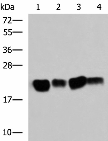 Western blot analysis of Mouse brain tissue SKOV3 cell Rat brain tissue Mouse kidney tissue lysates  using HRAS Polyclonal Antibody at dilution of 1:500