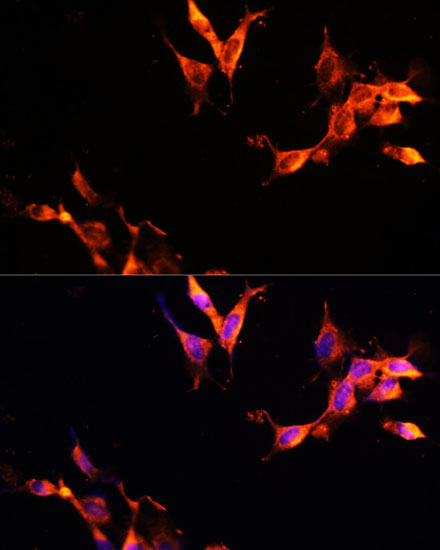 Immunofluorescence analysis of NIH-3T3 cells using LAMTOR1 Polyclonal Antibody at dilution of 1:100 (40x lens). Blue: DAPI for nuclear staining.