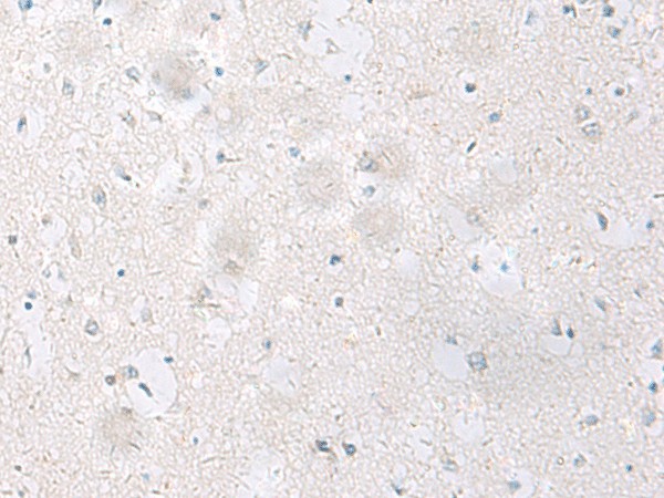 Immunohistochemistry of paraffin-embedded Human brain tissue  using SST Polyclonal Antibody at dilution of 1:60(?200)