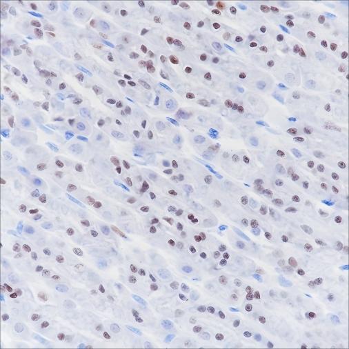 Recombinant SOX2 Monoclonal Antibody - small - 5