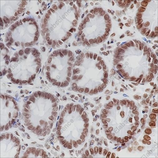 Recombinant ERCC1 Monoclonal Antibody - 2