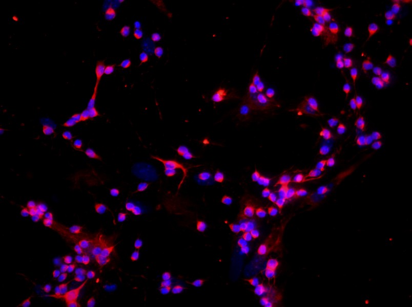 Mouse Retinal Ganglion Cell Complete Medium - 2